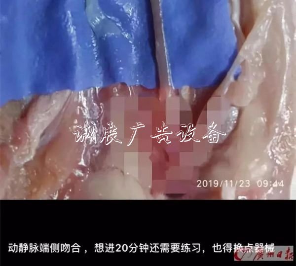 他每天都來買雞鴨翅，滾動燈箱但只買一個！真相讓網(wǎng)友